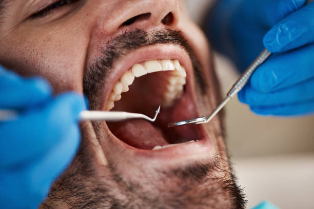 TMJ/TMD Treatment in Penitas, TX